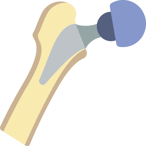 Hip Arthroplasty