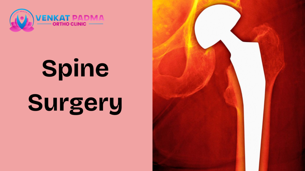 Spine Surgery